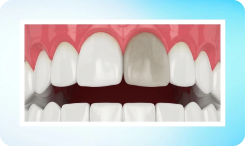 Boc-su-rang-hu-rang-chua-tuy