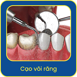 dich-vu-cao-voi-rang