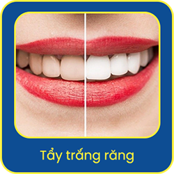 dich-vu-tay-trang-rang