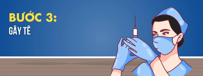 quy-trinh-nho-rang-3