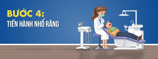 quy-trinh-nho-rang-4