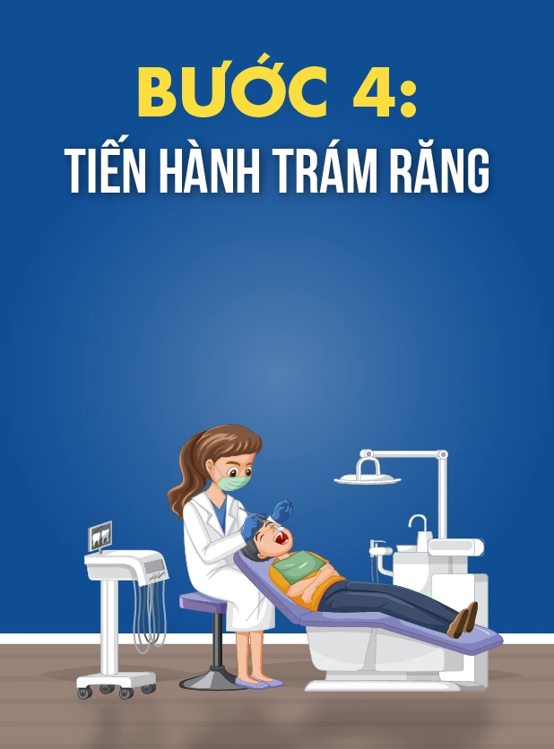 quy-trinh-tram-rang-b4