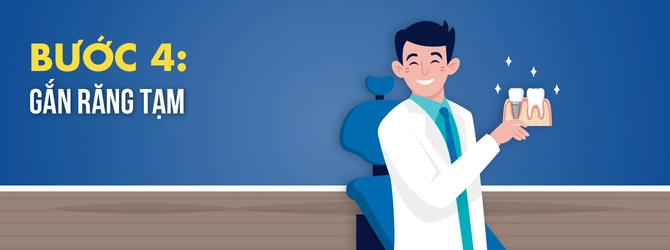 quy-trinh-trong-rang-implant-4