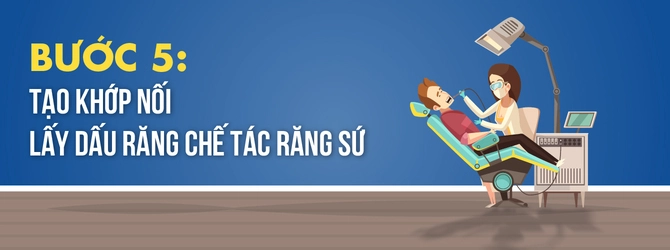 quy-trinh-trong-rang-implant-5