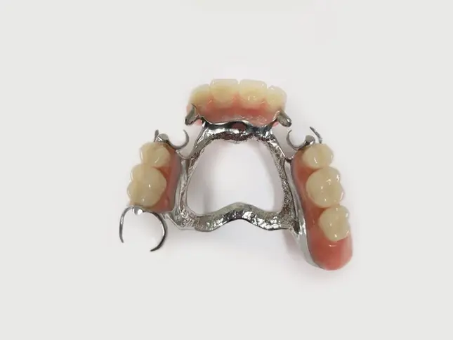 rang-gia-thao-lap-bang-khung-kim-loai-1