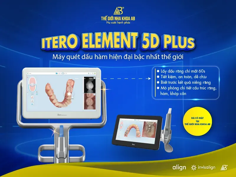 Máy quét dấu hàm iTero Element 5D Plus – Bước tiến mới trong niềng răng tại Thế Giới Nha Khoa AB