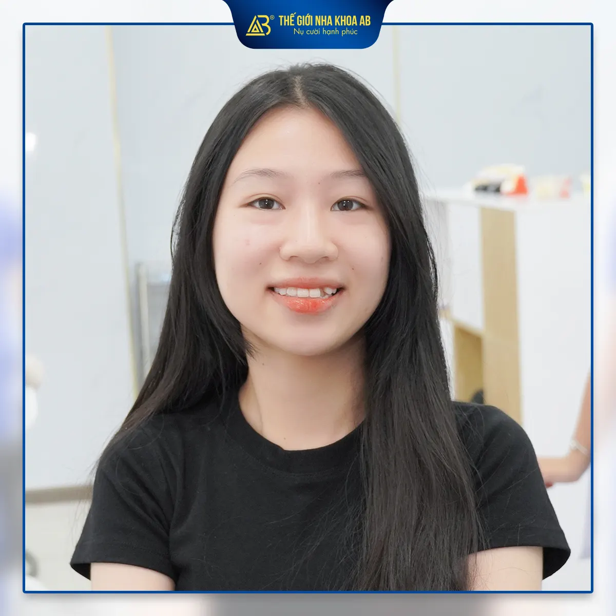 dich-vu-cao-voi-rang-2