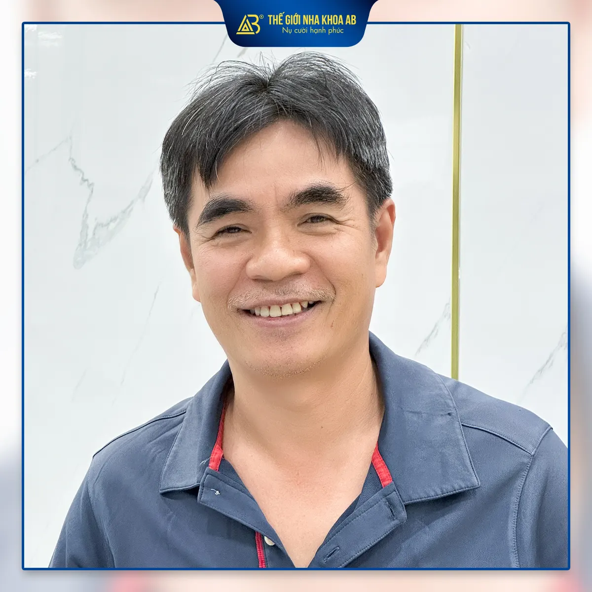 hinh-anh-khach-hang-trong-rang-implant-1