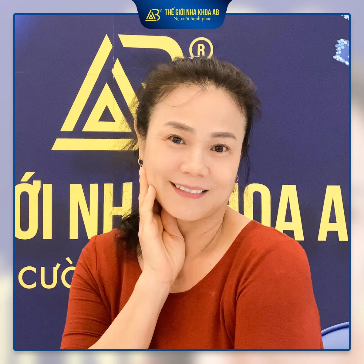 hinh-anh-khach-hang-trong-rang-implant-4