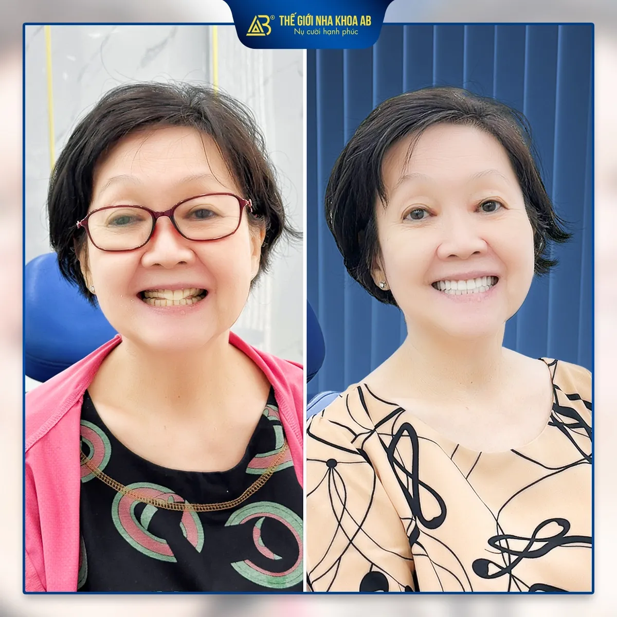 khach-hang-rang-gia-thao-lap-6